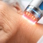 découvrez les différentes options de traitement pour la dermatoporose et évaluez leur efficacité afin de mieux comprendre cette affection cutanée.