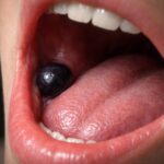 découvrez les mystères derrière la boule noire dans la bouche et comprenez ce que signifient ces anomalies buccales pour votre santé.