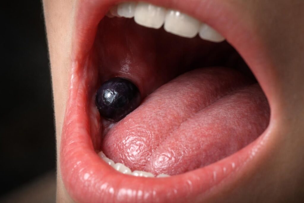 découvrez les mystères derrière la boule noire dans la bouche et comprenez ce que signifient ces anomalies buccales pour votre santé.