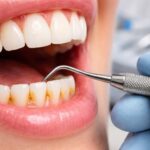 découvrez des méthodes efficaces pour éliminer le tartre dentaire et préserver la santé de vos dents grâce à nos conseils pratiques et faciles à suivre.